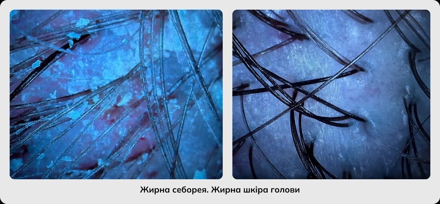 Трихологія Трихологія