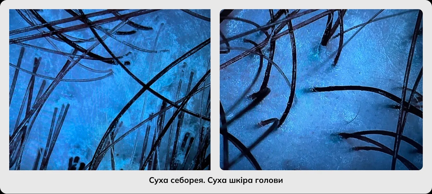 Трихологія Трихологія