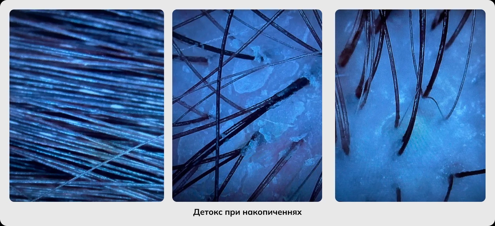 Трихологія Трихологія